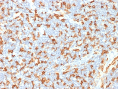 FFPE human lymph node sections stained with 100 ul anti-AIF1 (clone AIF1/1909) at 1:400. HIER epitope retrieval prior to staining was performed in 10mM Citrate, pH 6.0.